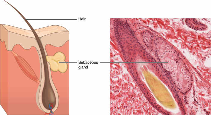Left: Illustration of a Sebaceous Gland Right: Picture of a Sebaceous Gland
