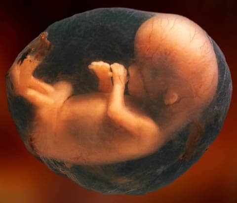 Normal Pregnancy and Childbirth With Fetal Development Photos - WeHaveKids