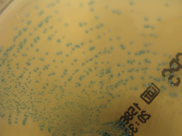 Group B Strep is a common bacteria - pregnant women will be screened for it in the third trimester and treated during labor, if necessary.