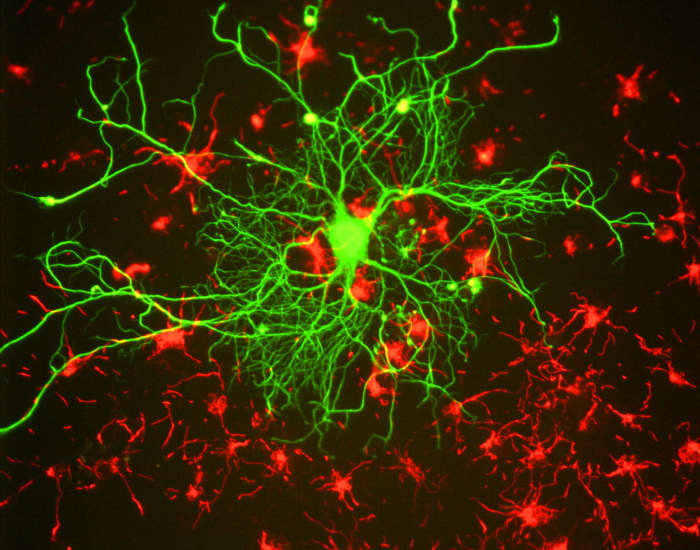 Cortical neuron stained with antibody to neurofilament subunit NF-L in green. In red are neuronal stem cells stained with antibody to alpha-internexin.
