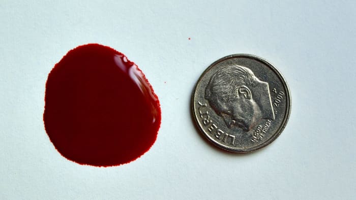 One way to explain to your doctor how much blood is coming from your vagina is to use coins for reference.