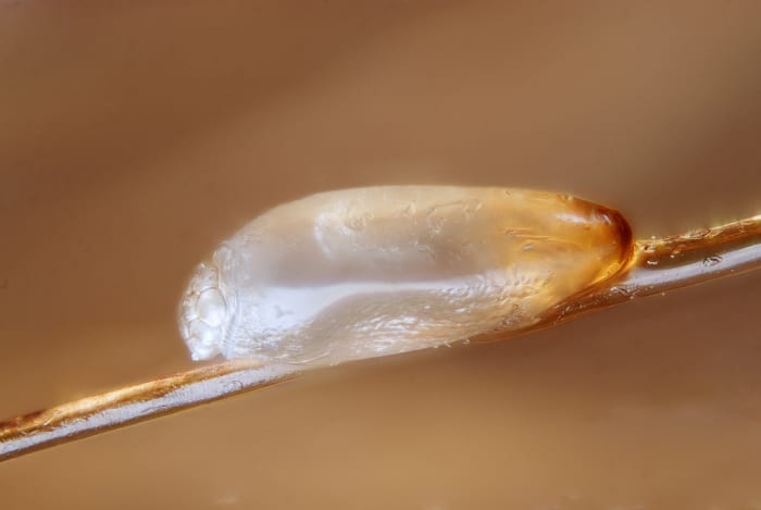 They are small half circle pods attached to a strand of hair. They resemble tear drops in shape and can be white or clear in color.