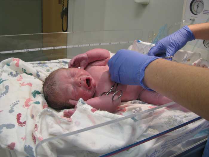 Repeat C-Section: I had to have a second c-section for the birth of my daughter, who came three weeks before my scheduled date.