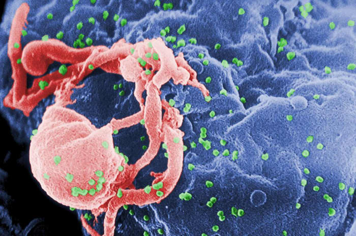 HIV budding from an infected lymphocyte