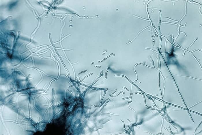 A species of Streptomyces with branching filaments and chains of spores