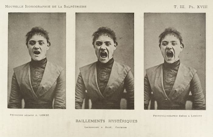 Hysteria is widely discussed in the medical literature of the Victorian era. In 1859, a physician claimed that a quarter of all women suffered from hysteria. He cataloged possible symptoms, which included faintness, nervousness, insomnia, fluid reten