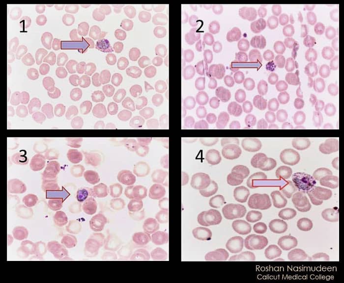 Stages in the life cycle of Plasmodium vivax