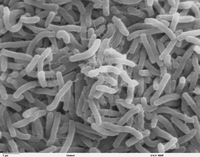 A scanning electron microscope image (SEM) of cholera bacteria. Bacterial respiration often breaks down glucose molecules to produce methane
