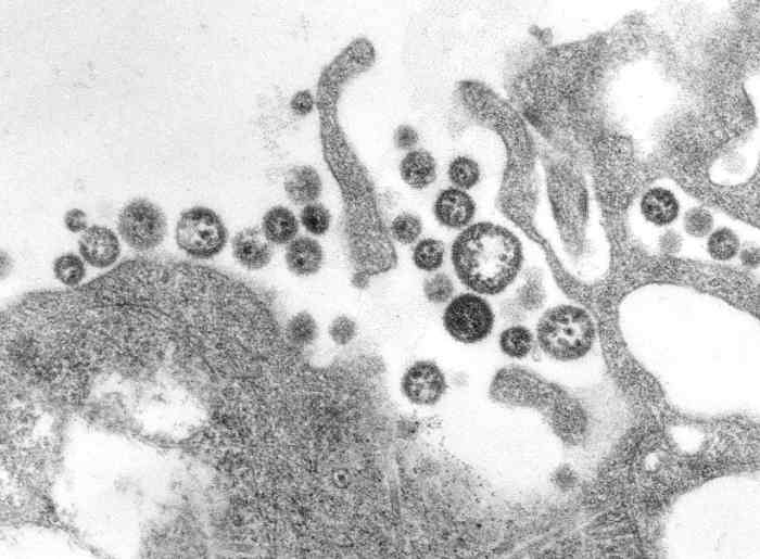 The infamous Lassa virus