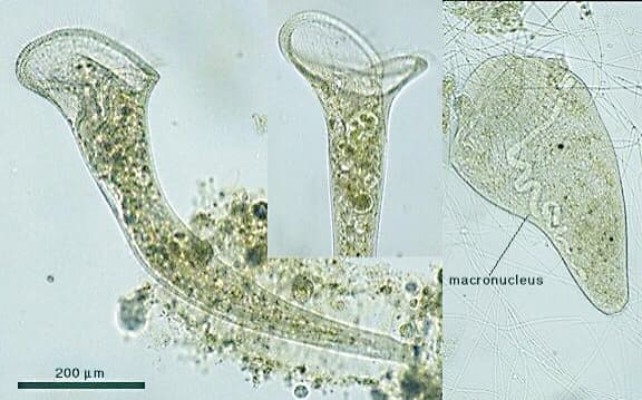 Stentor, a microscopic pond creature, as seen under a microscope