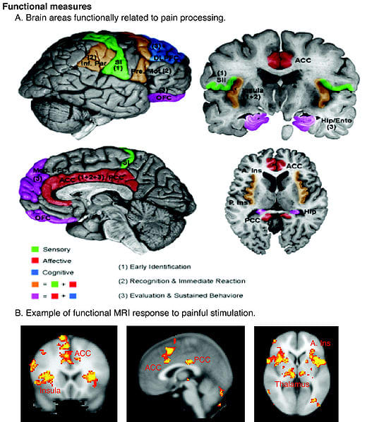 Our brain processes pain in different areas