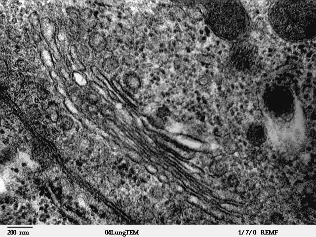 The cytoplasm is the substance within the cell membrane, which holds all the organelles and in which the processes of metabolism take place.
