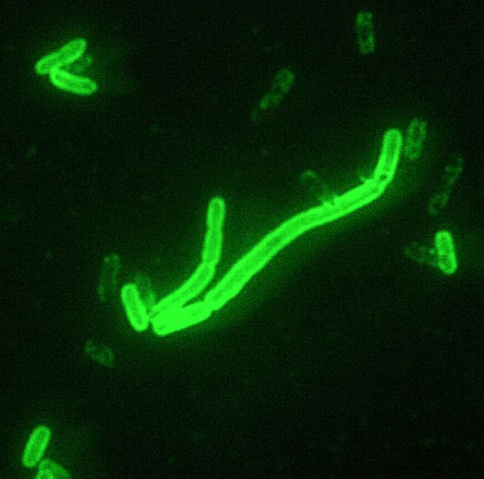 Yersinia pestis cells coloured by a fluorescent stain