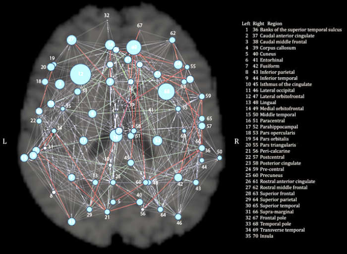 Genetic brain maps, in particular, can show whether we inherit patterns of brain structure from our parents, and if so, to what degree. We want to understand which parts of the brain are most strongly determined by our genes.