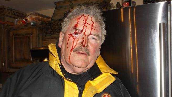 While collecting rabbits from his snares in the woods, this man was attacked by a great horned owl.