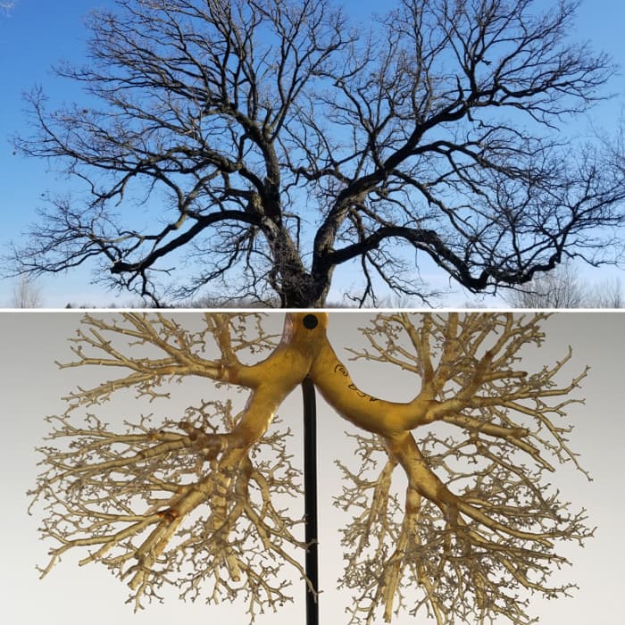 A tree and lung bronchials demonstrating the life giving properties of trees. Trees give off the oxygen that our lungs receive, giving life to our bodies.