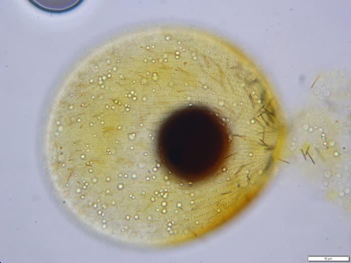 The ciliate Prorodon has an extremely diverse diet, feeding on anything from algae to flagellates, ciliates and even microscopic worms