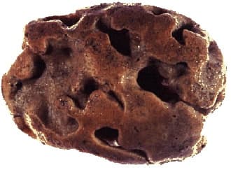 Halichondria belong to genus desmosponges. These sponges are known for their cell-division limiting capacity.
