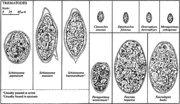 Trematode eggs found in the urine and/or faeces can be distinguished based on shape and the presence and positioning of the spine