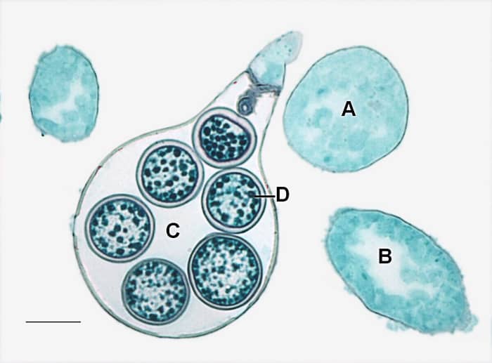 An oogonium containing oospheres