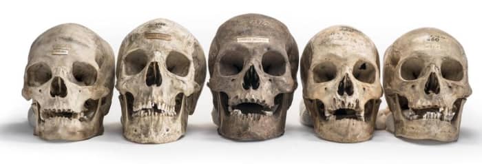 Skulls from the collection of Samuel Morton, the father of scientific racism, illustrate his classification of people into five races—which arose, he claimed, from separate acts of creation.