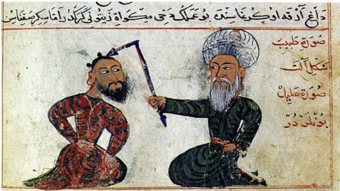 "Epilepsy treatment from the surgical atlas Cerrahiyetül Haniye (Imperial surgery). Drawn in the 15th century (1465). Collection: Ataturk Institute for Modern Turkish History, Istanbul, Turkey. Artist: Sefereddin Sabuncuo ğ lu" Research Gate