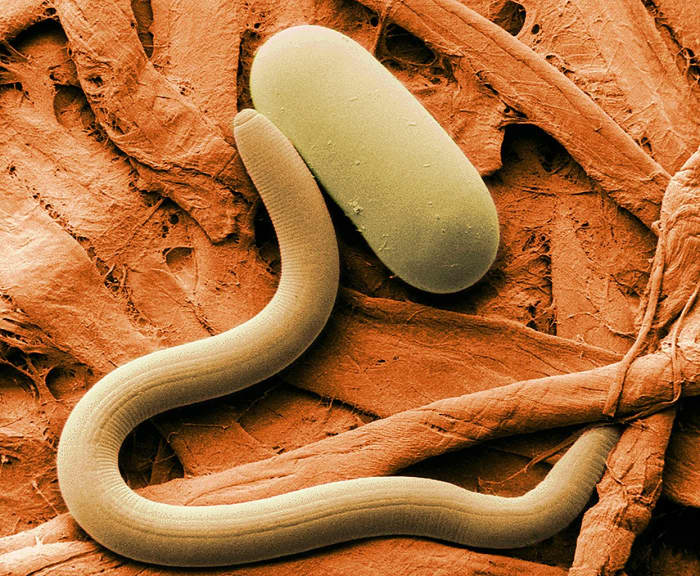 A soybean cyst nematode and an egg (colourized scanning electron micrograph)