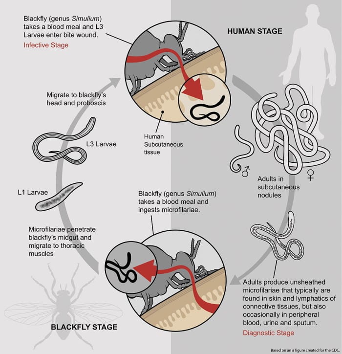 Overview of Onchocerca volvulus life cycle