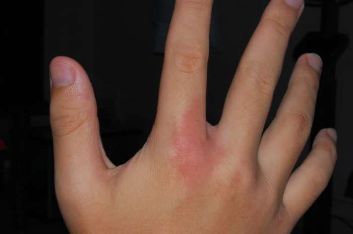 Do Centipedes Bite? - Owlcation