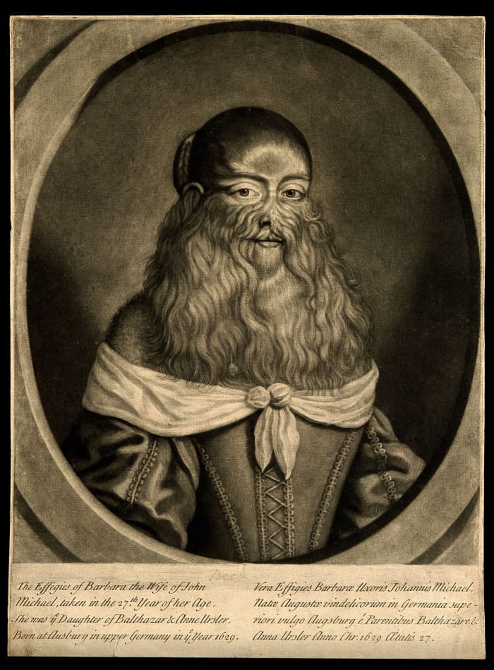 A mezzotint of Barbara van Beck, from the Wellcome Library of London, England.
