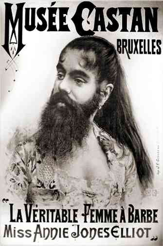 Bearded Ladies in History - Owlcation