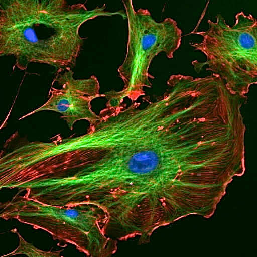 These are cells from a cow that have been stained to show the cytoskeleton. Blue = nucleus, green = microtubules, red = actin filaments