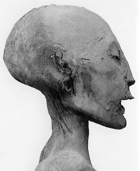 The head of the mummy of the 'Younger Lady' - identified by the DNA analysis as the mother of Tutankhamun