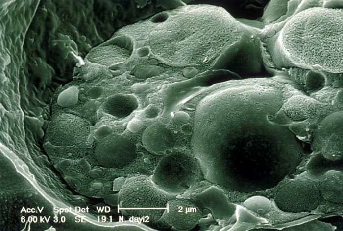 The chytrid fungus could be considered beautiful in this photo obtained via an electron microscope. Its effects are the opposite of beautiful, however.