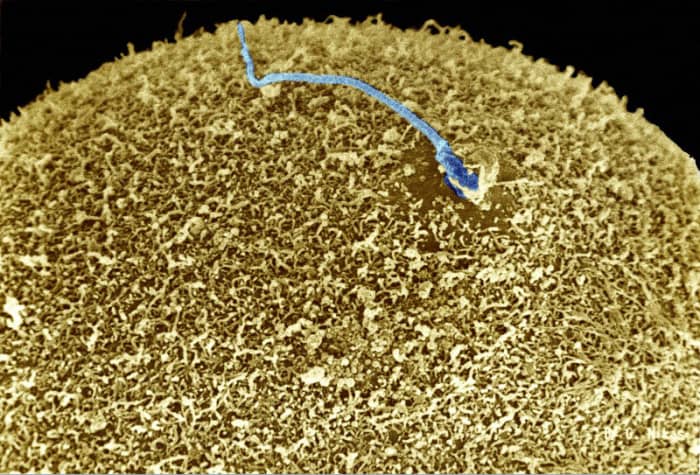 The start of animal life - the fertilisation of an egg by a sperm cell. All living things reproduce, something non-living things cannot do.