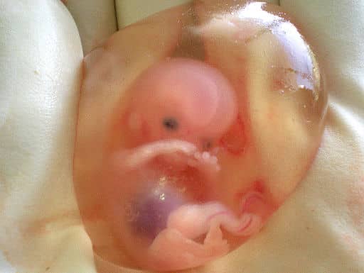 Babies of mammals grow inside a bubble filled with nutritious water called the amniotic sac. The water cushions them and helps propel them out of the womb at birth.