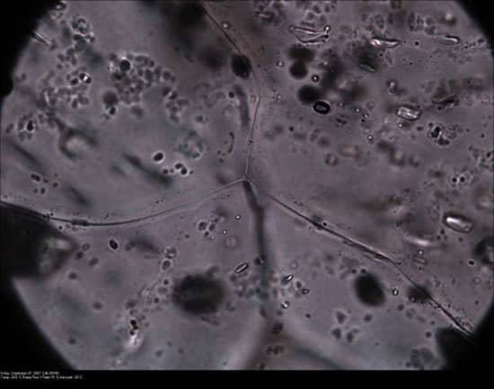 The rain-making bacteria Pseudomonas syringae.