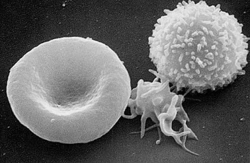 From left to right: a red blood cell, an activated platelet or thrombocyte, and a white blood cell