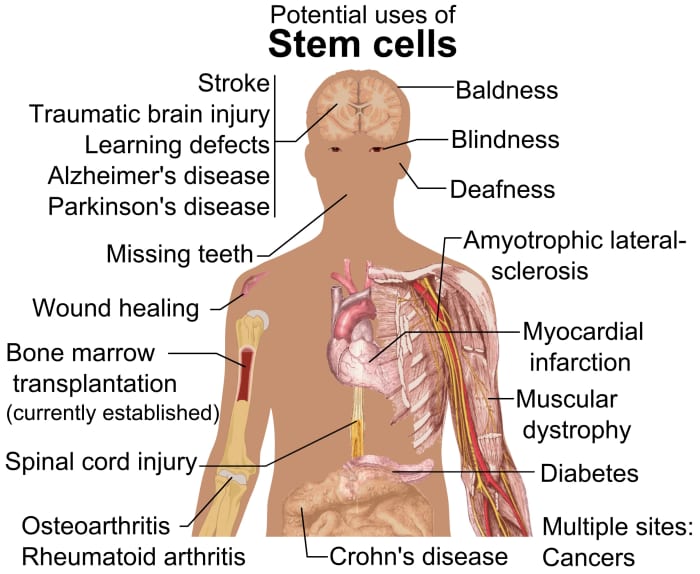 Some potential uses of stem cells to repair damage in the body