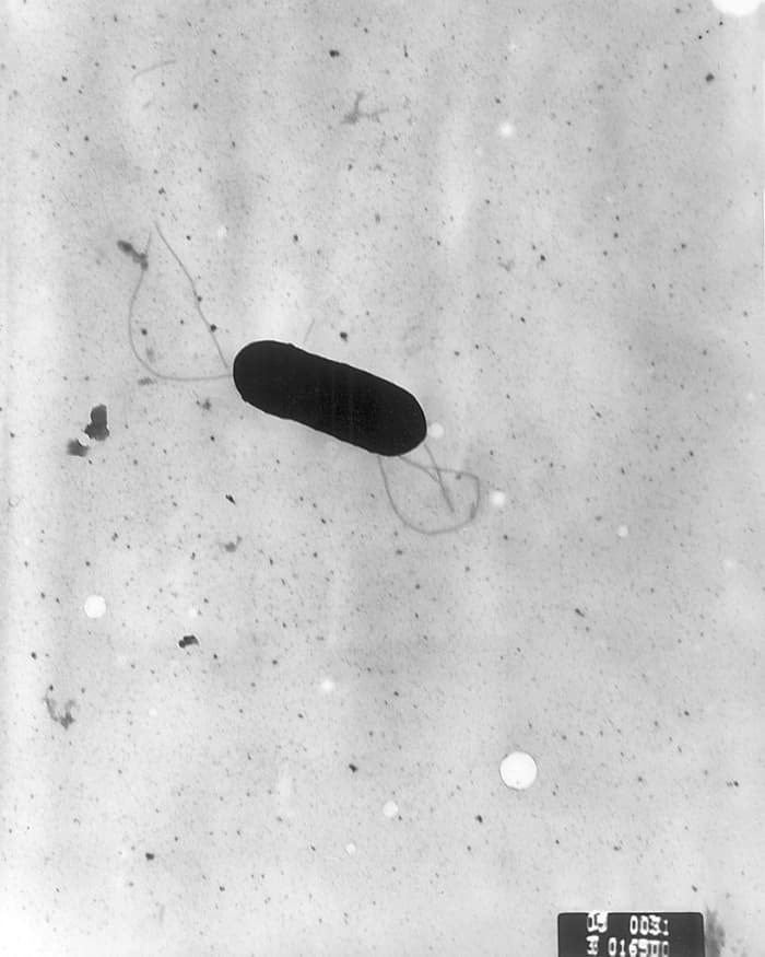 Listeria monocytogenes has multiple flagella on its body..