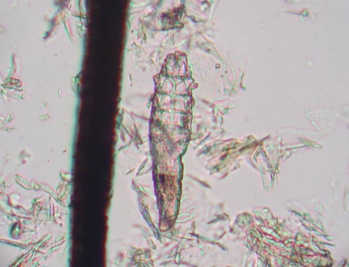 Demodex canis at 400x