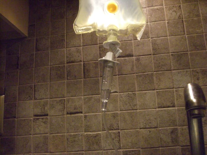 The drip chamber; when starting the fluid flow, watch this to measure how fast it's flowing. You want drops—not a steady stream.