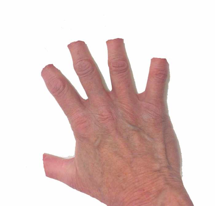 Why You Should Never Declaw Cats PetHelpful