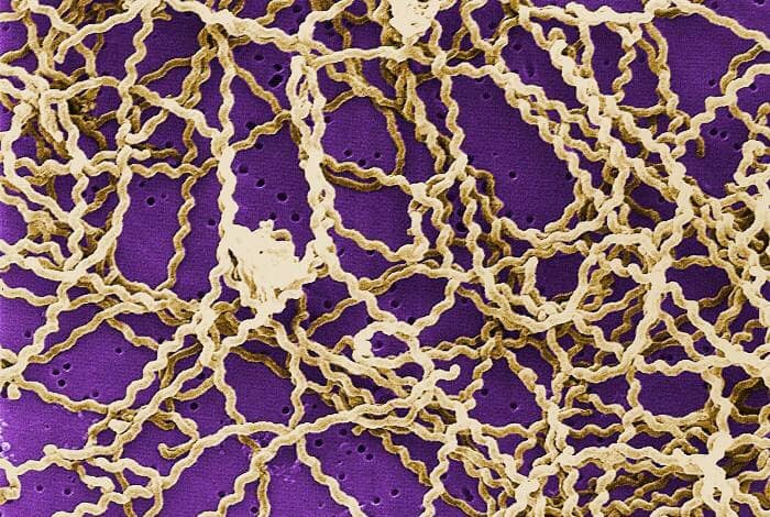 Leptospira bacteria that have collected on a polycarbonate filter (colourized photo)