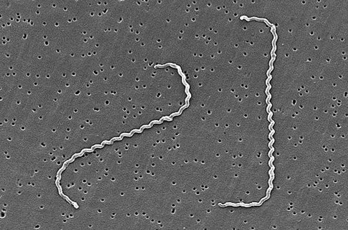 Leptospira interrogans as viewed under a scanning electron microscope; the bacteria have been trapped on a filter