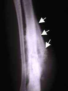 Dog osteosarcoma Codman triangle