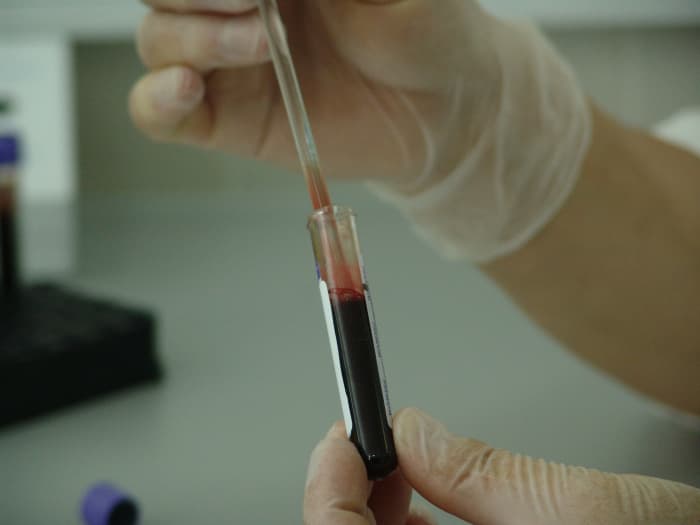 Can you imagine being secretly tested for certain diseases and conditions by your employer? That's what happened to employees in several high profile cases leading up to the passage of GINA.