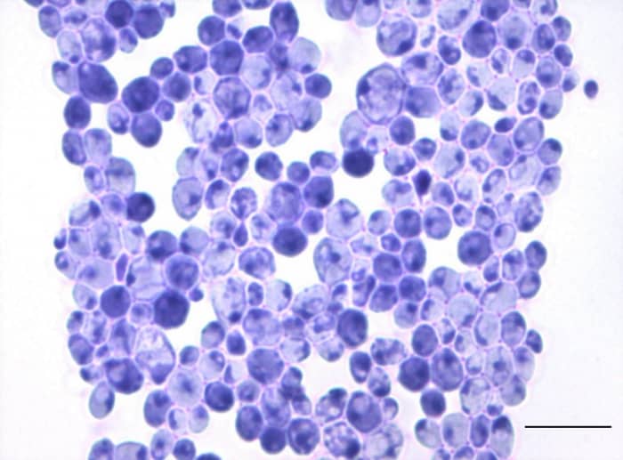 Another view of Candida albicans