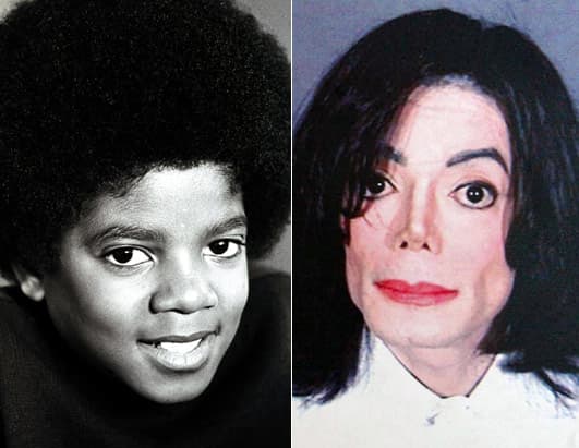 The Changing Face of Michael Jackson - Spinditty