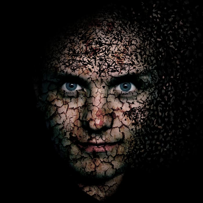 Narcissistic Personality Disorder affects about one percent of the population and involves a preoccupation with personal adequacy, power, prestige and vanity.